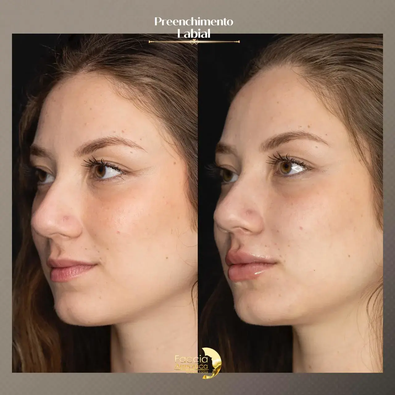 jjauiwrm0cewhly21g1o (1)