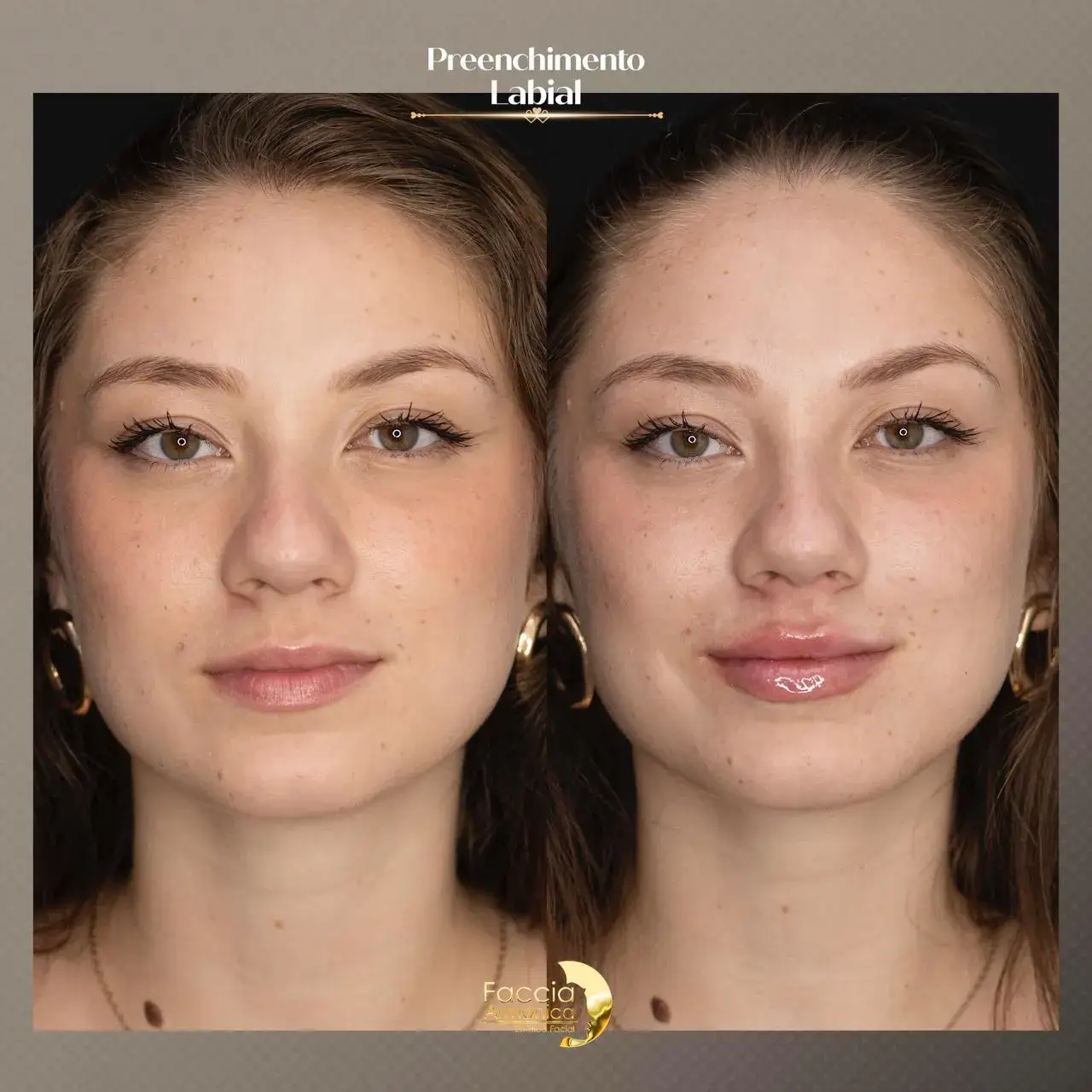 juqunix4c8g7lvcwj8me (1)