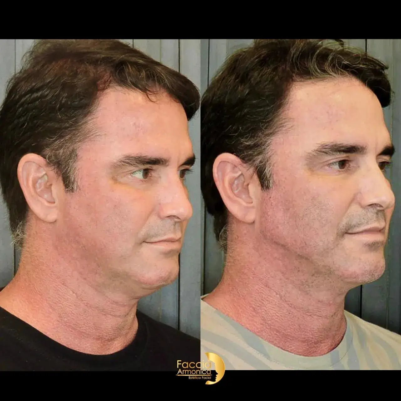 qxlqf7rk6vq5had5vawr (1)